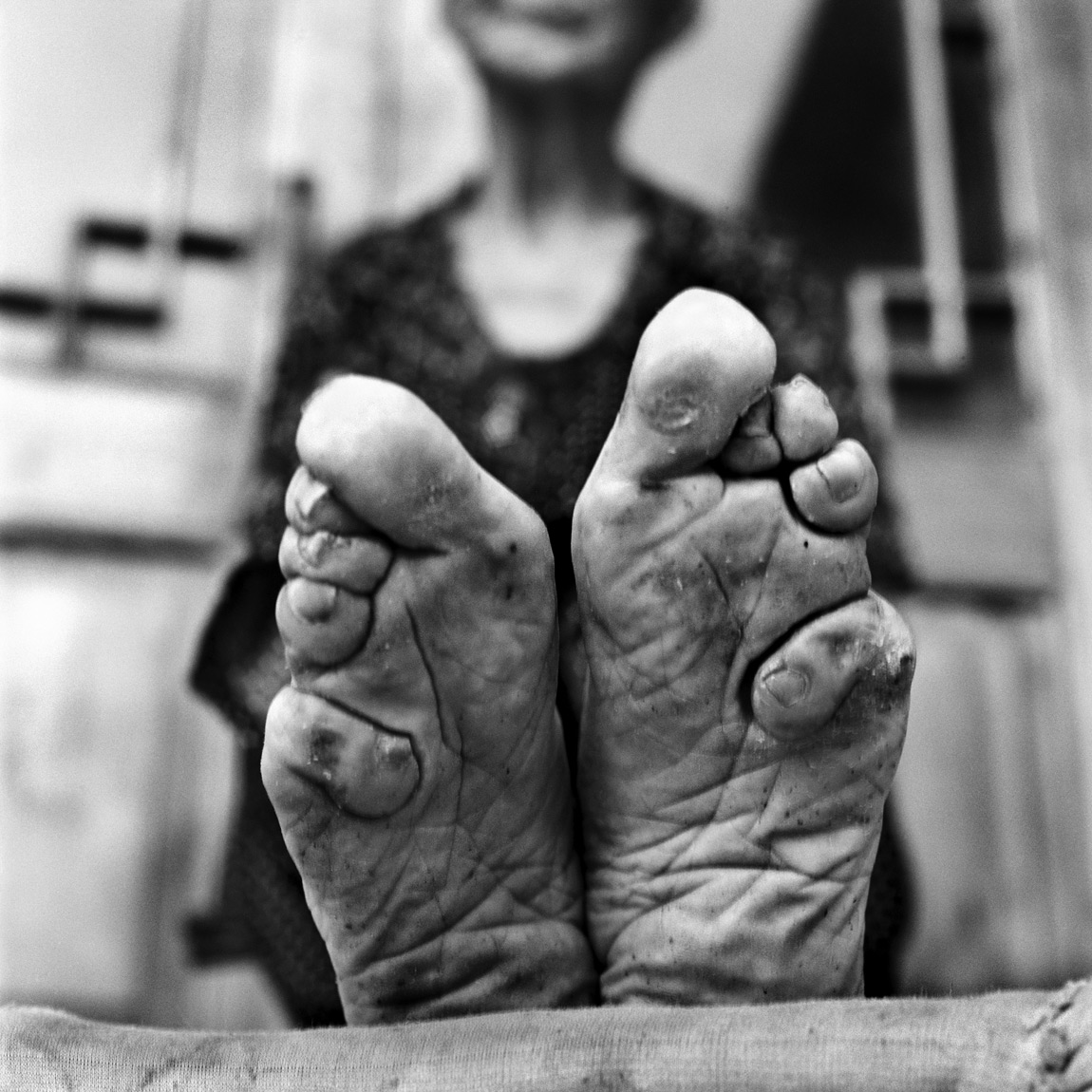 China Photo Story: The Last Survivors of Crippling Foot Binding Tradition
