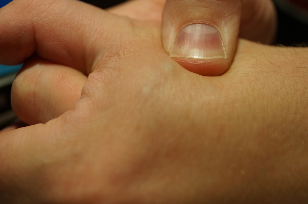Microchipped office workers are ‘very 2015’