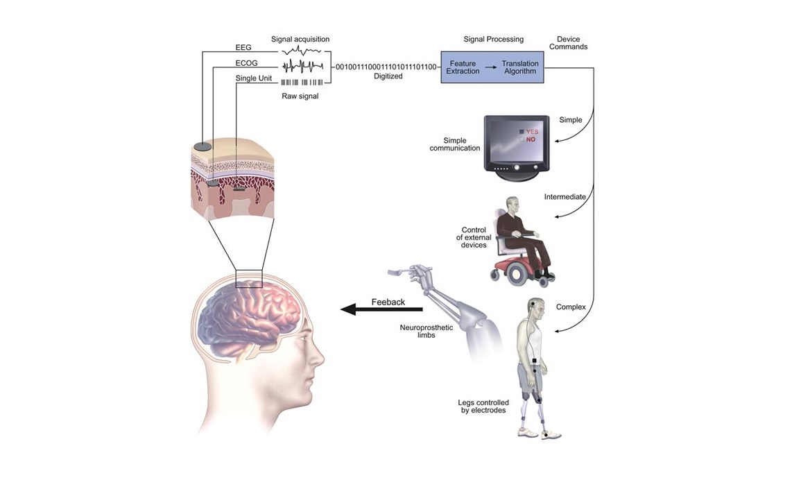 Robotic Arm Learns Intentions Of User With Breakthrough Brain-machine ...