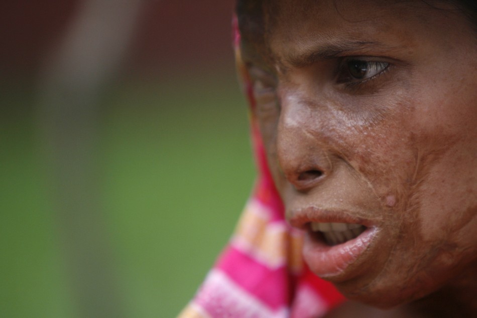 Pakistan Acid Attack Film Highlights Growing Social Problem