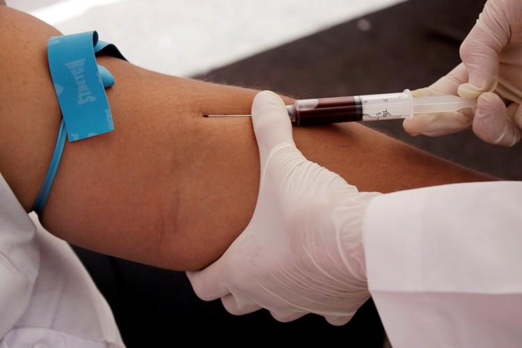 Blood Test for Cancer Cells