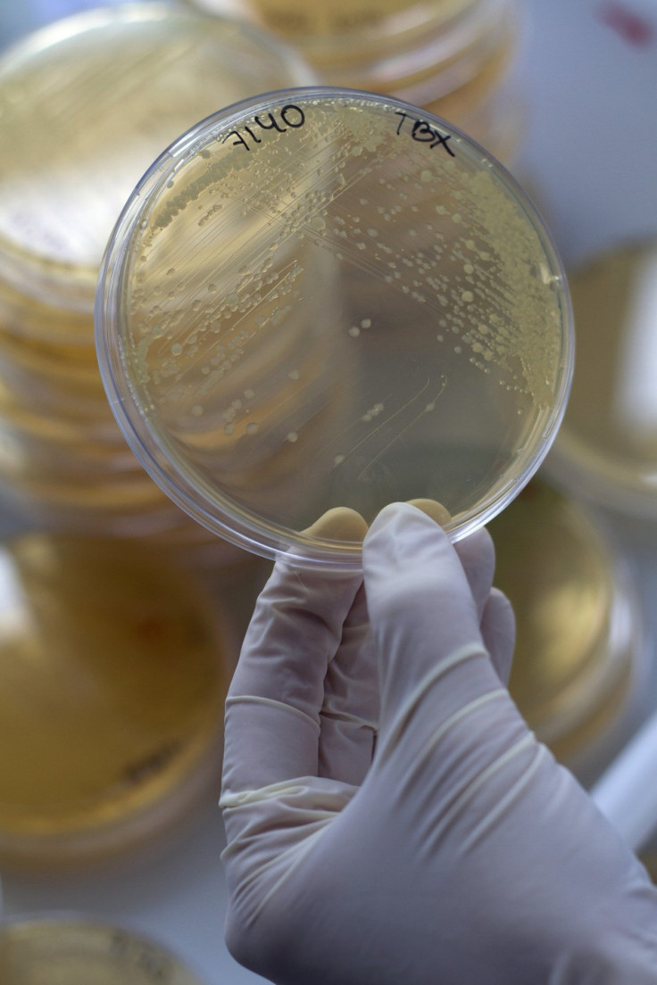 E.coli E.coli
