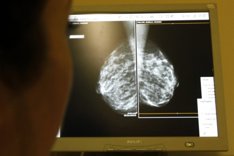 Woman's mammogram