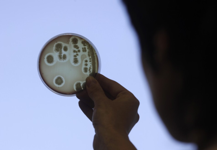 E. coli petri dish