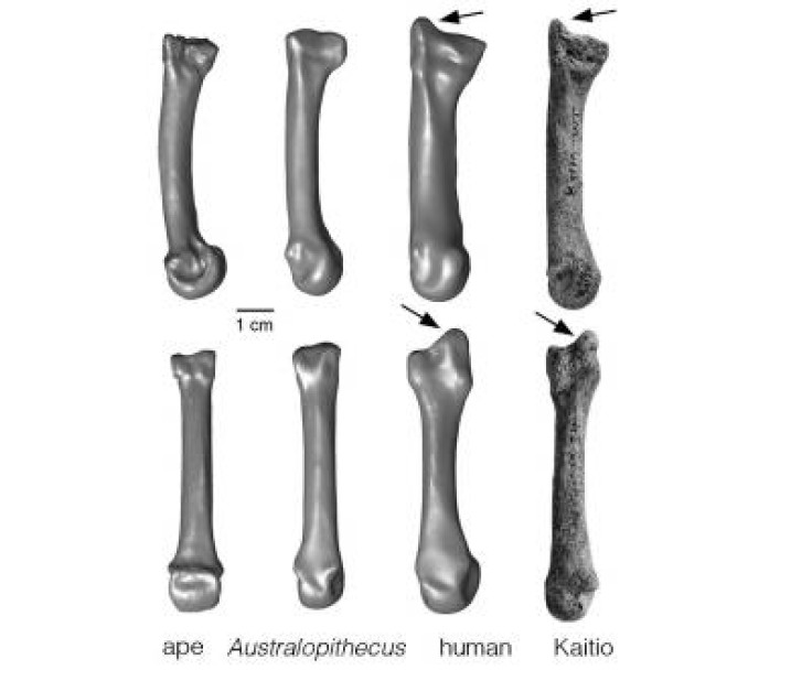 Human hand bone
