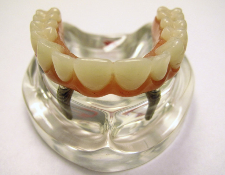 A display model of a dental implant is seen at the Nobel Biocare manufacturing facility in Yorba Linda, California.