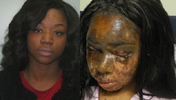 Acid attack - Naomi Oni and Mary Konye