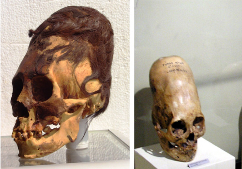 Paracas Elongated Skulls - were they human?