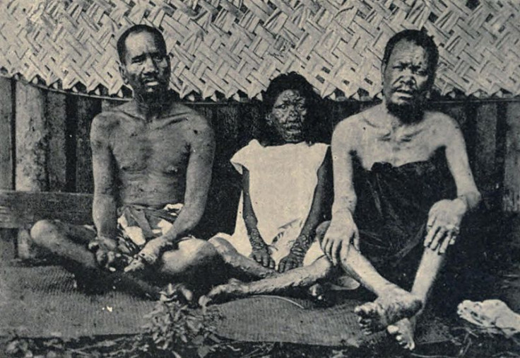 Lepers in Tahiti in 1898