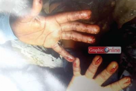 Morrison Adenkor and Angelina Adet