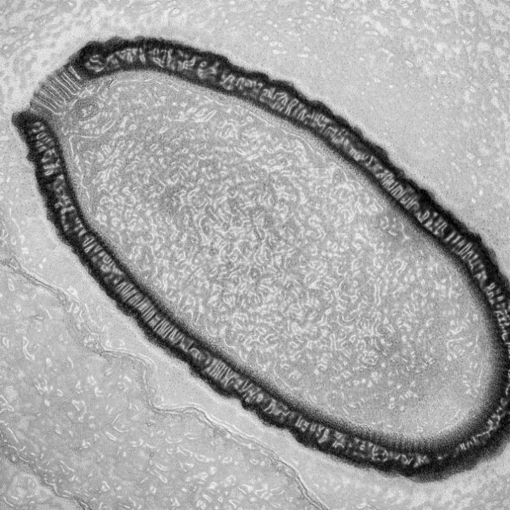 Pithovirus sibericum