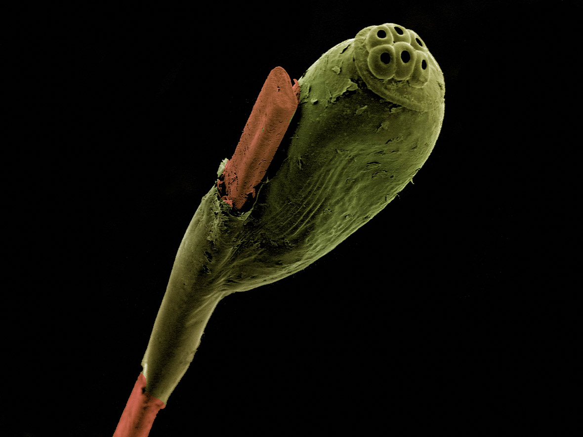 Head louse egg attached to a strand of hair, SEM