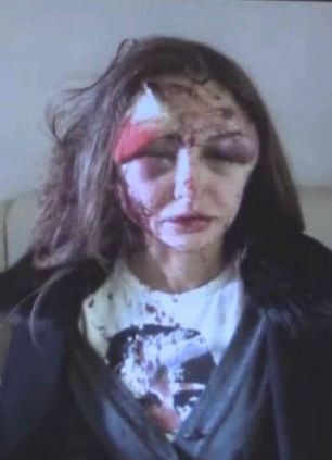 Model Battered by Tycoon Boyfriend