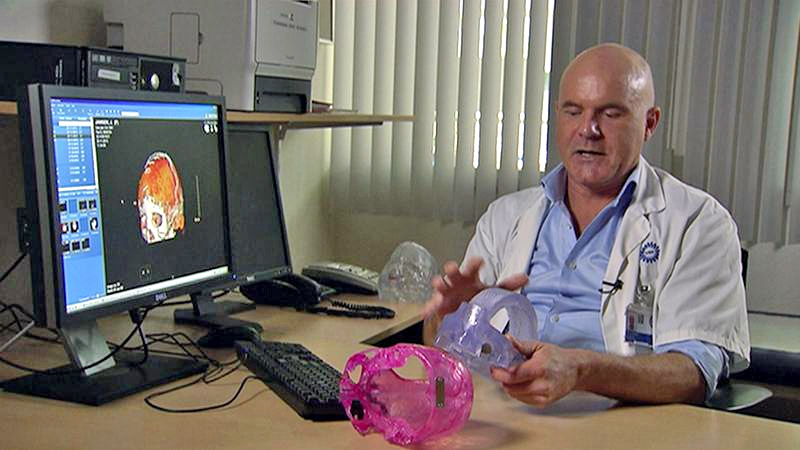 Dr. Bon Verweij implanted the first full 3D-printed skull replacement in a young Dutch woman Dr. Bon Verweij implanted the first full 3D-printed skull replacement in a young Dutch woman