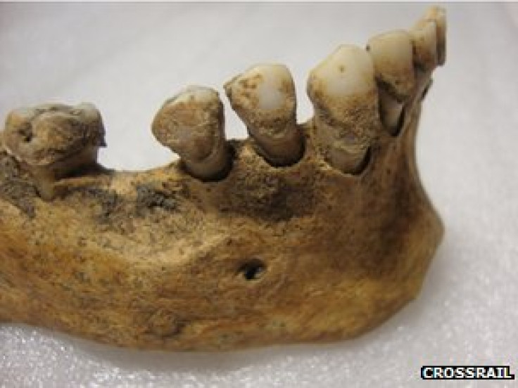 The 14th-century Black Death victims' teeth contain DNA from the plague bacterium Yersinia pestis