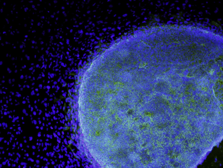 Embryonic Stem Cell