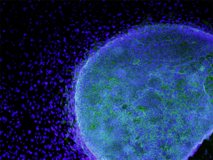 Embryonic Stem Cell