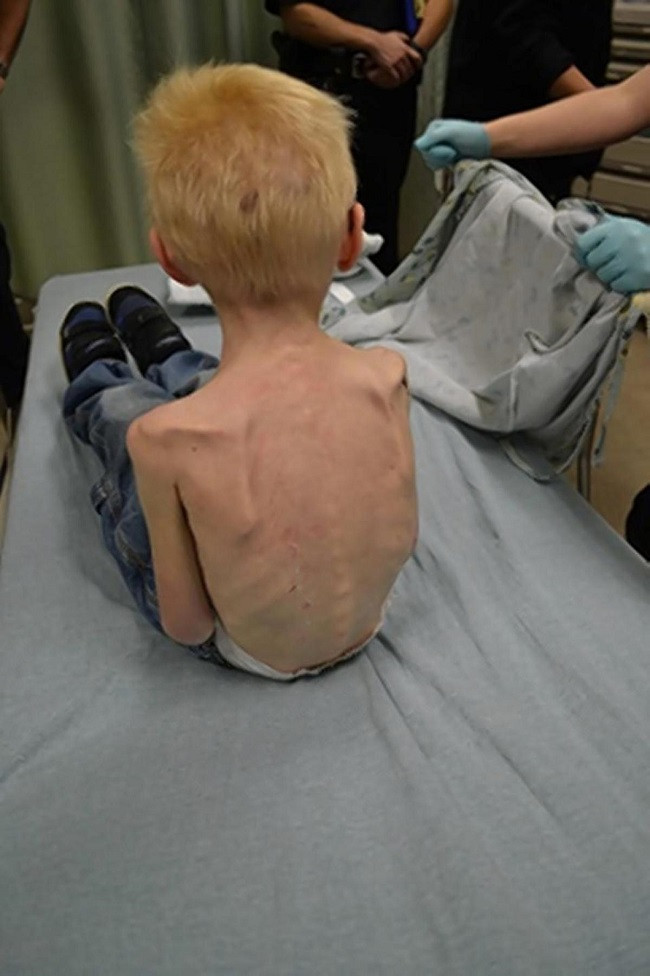 Five-year-old locked away by parents to starve Five-year-old locked away by parents to starve