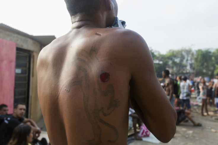 A resident of Telerj slum shows what he claims is a rubber bullet wound