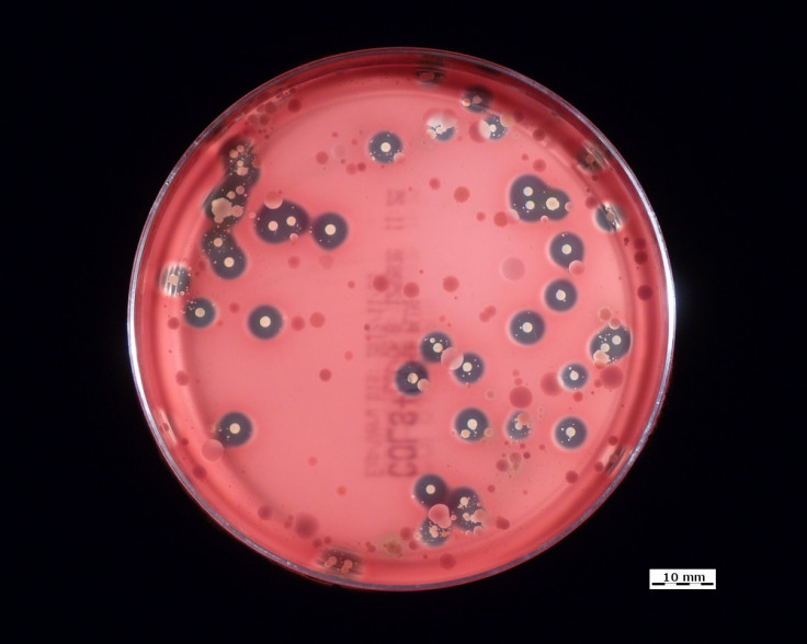 Group A β-hemolytic streptococcus