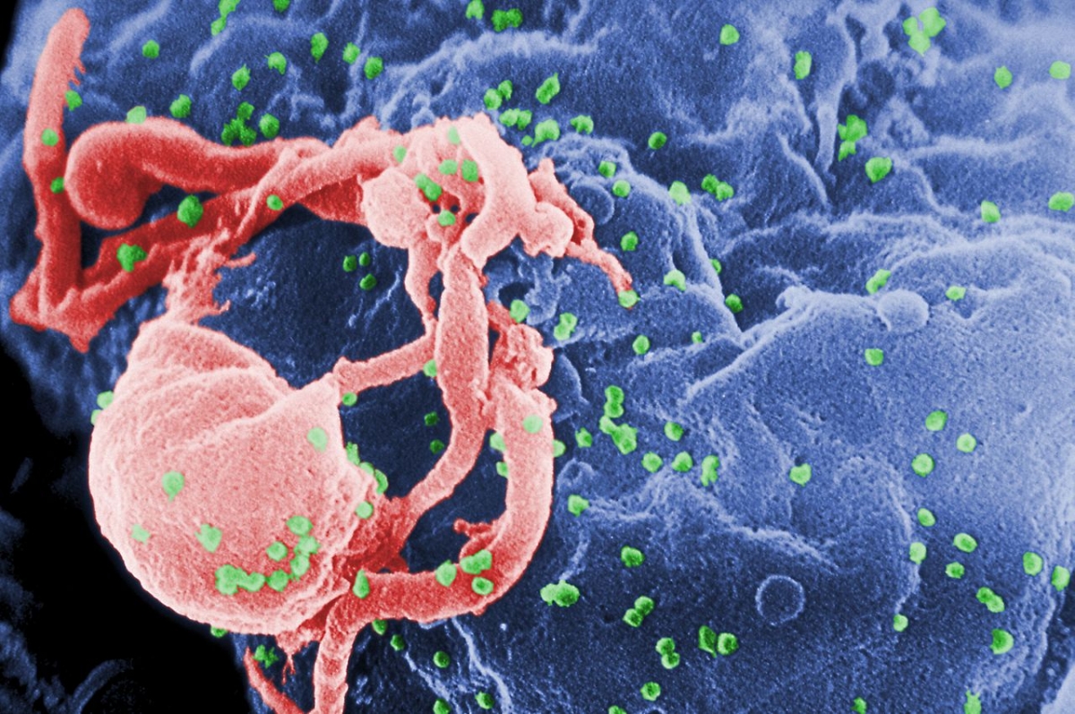 HIV: Genetic Mutation Leads to Two Men Being 'Spontaneously Cured' of Virus