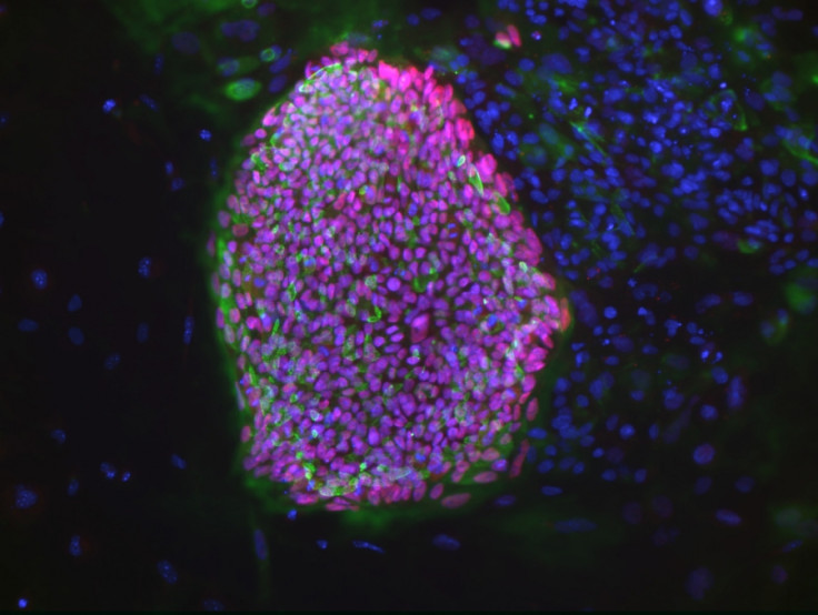 embryonic stem cells