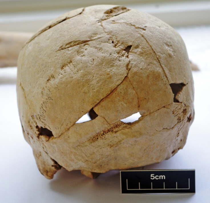 A close-up of the back of Skeleton 180's skull, which has 6 sword wounds