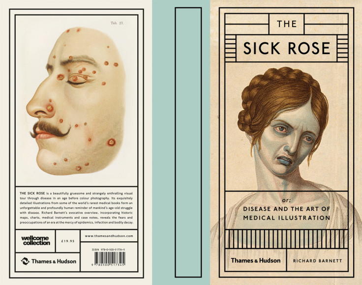 The Sick Rose or Disease and the Art of Medical Illustration