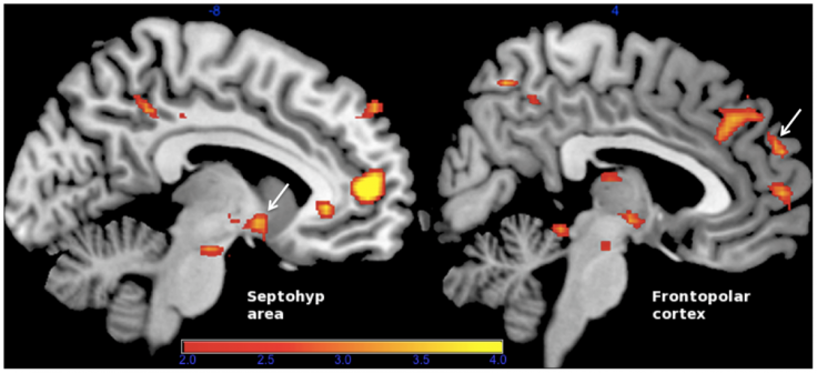 Comparison of tenderness/affection vs. pride during neurofeedback training