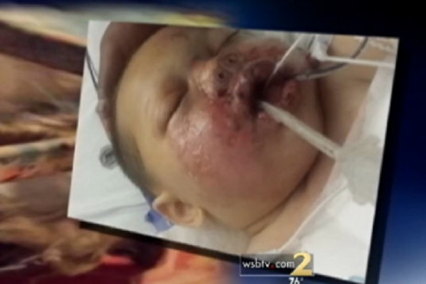 Baby hurt in wrong grenade attack