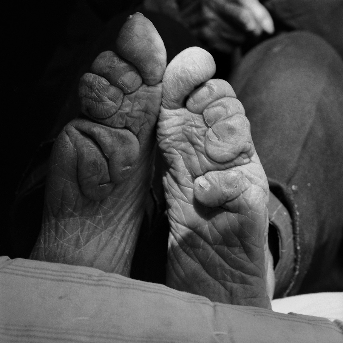 China Photo Story: The Last Survivors of Crippling Foot ...