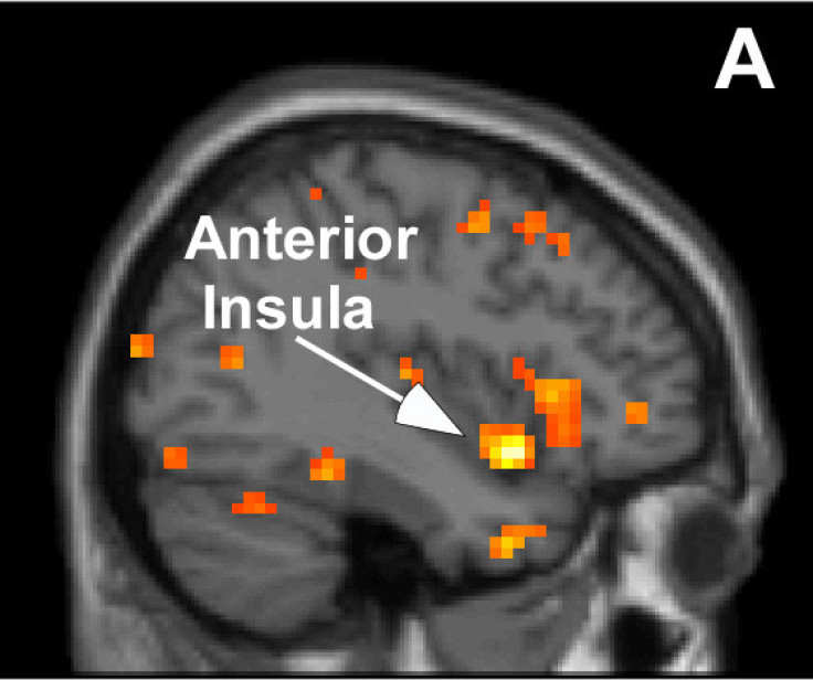 The fMRI brain scan of a highly sensitive person