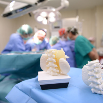 A 3D-printed model of organs and a tumour