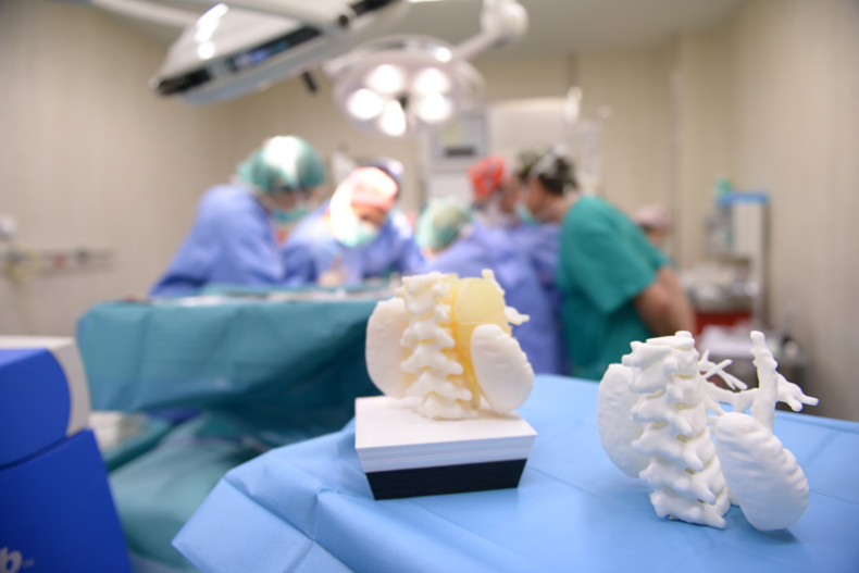 A 3D-printed model of organs and a tumour