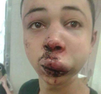 Tareq Abu Khadair, 15, was reportedly beaten up by Israeli security forces during clashes between police and Palestinian protesters. Tareq Abu Khadair, 15, was reportedly beaten up by Israeli security forces during clashes between police and Palestinian protesters.