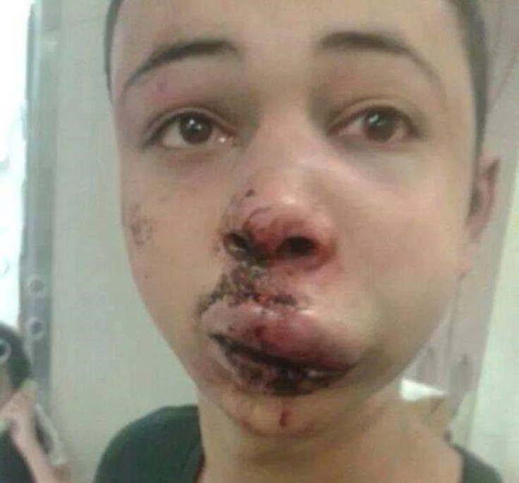 Tareq Abu Khadair, 15, was reportedly beaten up by Israeli security forces during clashes between police and Palestinian protesters.