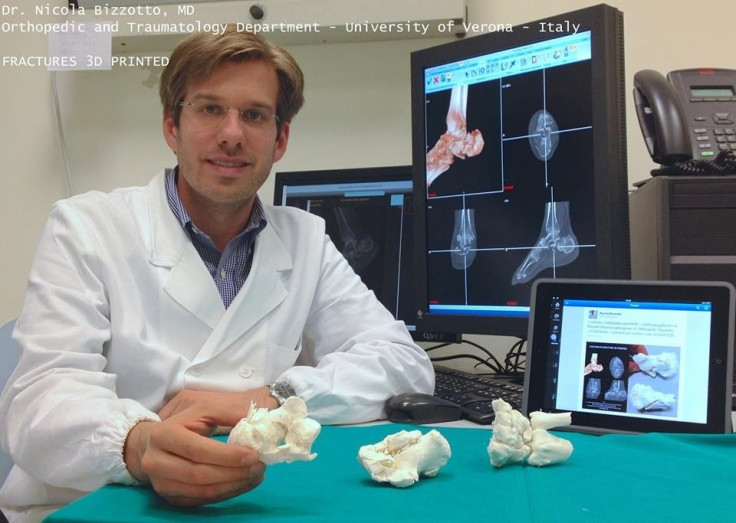 Dr Nicola Bizzotto and his 3D-printed bone replicas