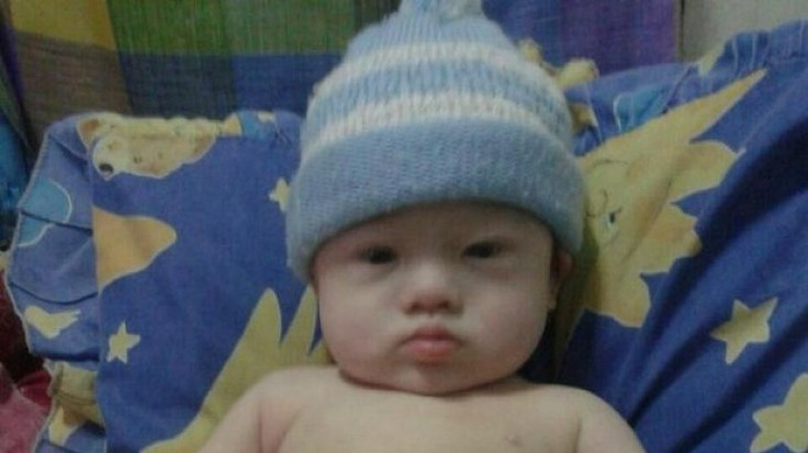 Down syndrome child Thai surrogate
