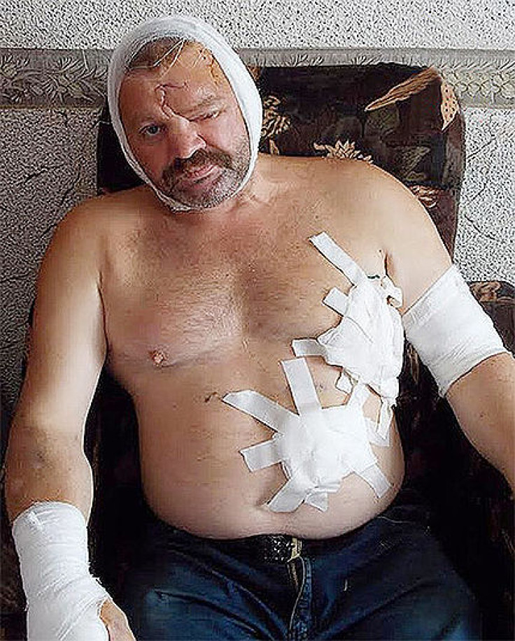 Igor Vorozhbitsyn injured by a Bear attack