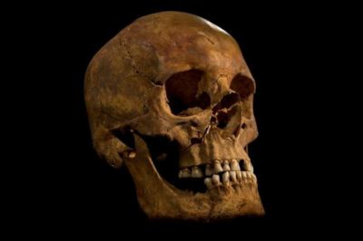The skull of Kind Richard III (University of Leicester)