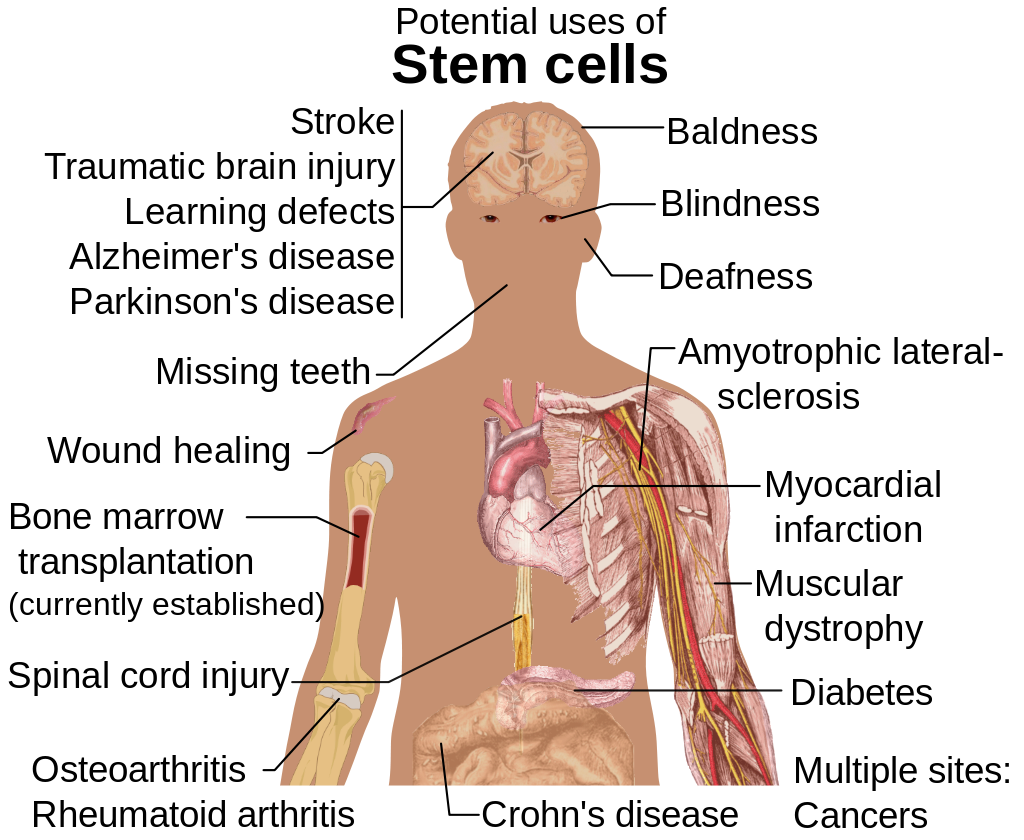 Stem cells could be used to repair many types of injuries Stem cells could be used to repair many types of injuries