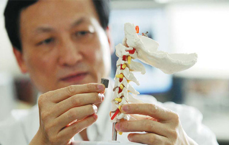 Liu Zhongjun, director of orthopaedics Peking University Third Hospital, holding a 3D-printed vertabra