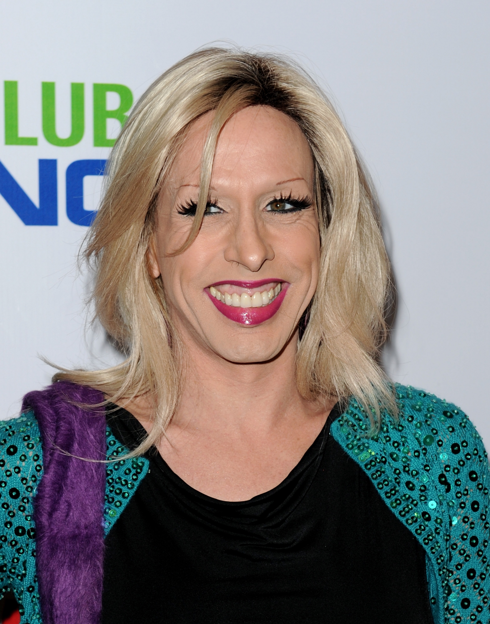 Transgender activist Alexis Arquette died from heart attack after