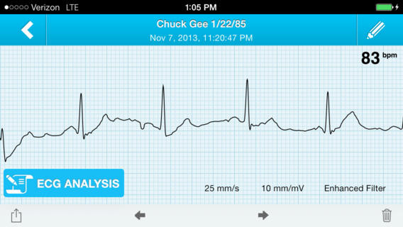 New Technology Approved by American FDA Converts Your Smartphones to Heart Monitors New Technology Approved by American FDA Converts Your Smartphones to Heart Monitors
