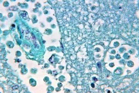 Brain-eating Naegleria fowleri amoeba found in several towns' water supply