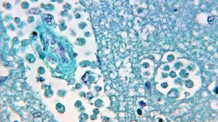 Brain-eating Naegleria fowleri amoeba found in several towns' water supply