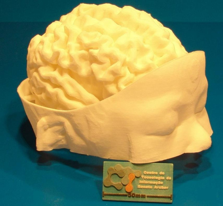 3D-printed model of an infant's brain