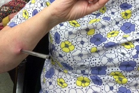 This image shows how hard the pen was stabbed in to Cynthia Bell in Blackpool coach attack
