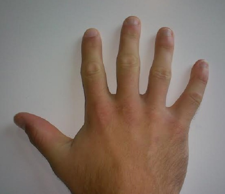 Longer ring finger linked to big testicles