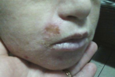 Handout picture of a mentally handicapped child with signs of physical abuse